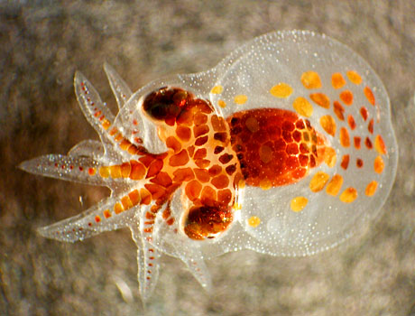 NOAA Image of an octopus larva a seen under a microscope